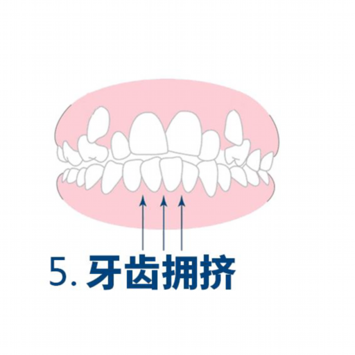 探讨种植牙850元一颗的真实性：费用包含哪些部分，价格是否靠谱一览